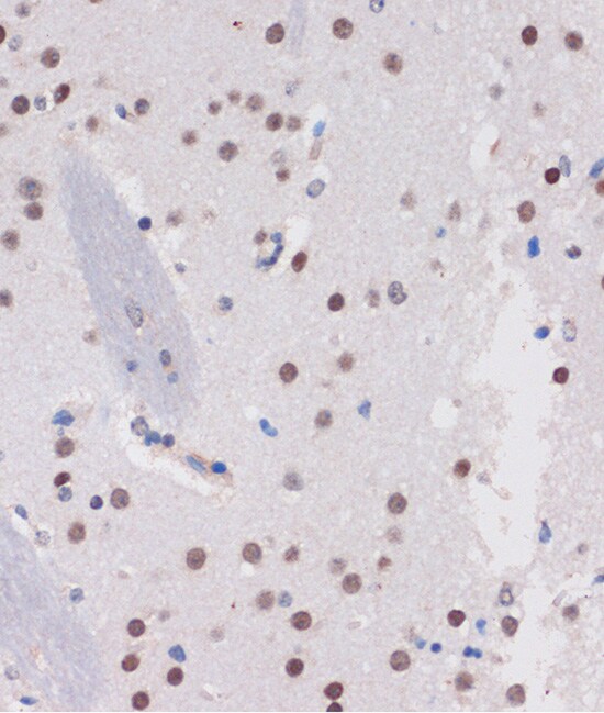ARID1B Antibody