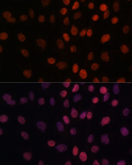 ARID1B Antibody