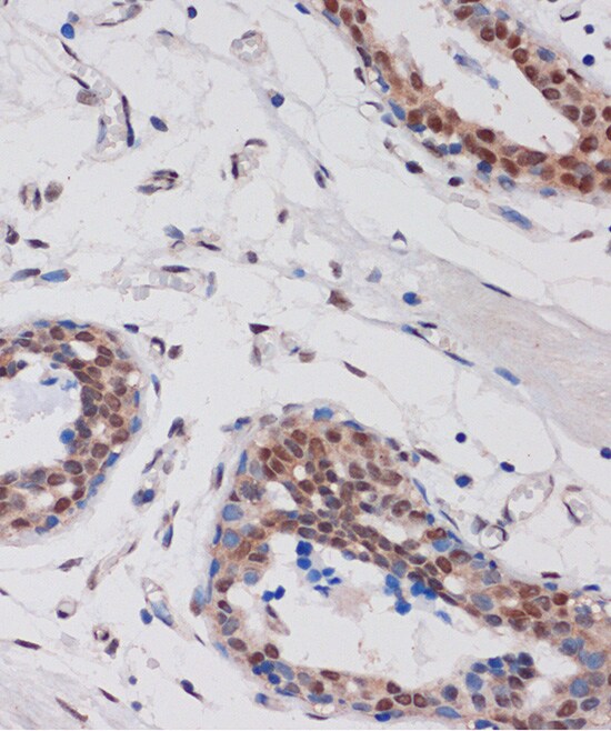 ARID1B Antibody