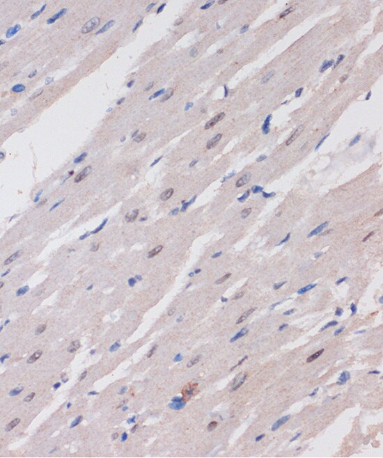 ARID1B Antibody