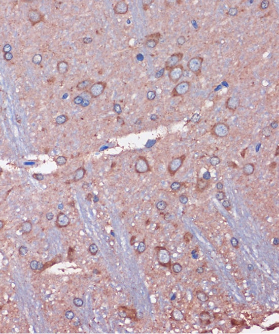 WDR61 Antibody