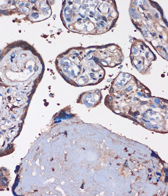 WDR61 Antibody