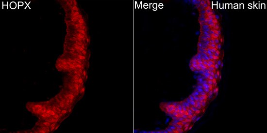 HOP Antibody