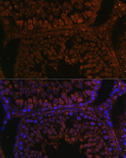 TPD52L3/D55 Antibody