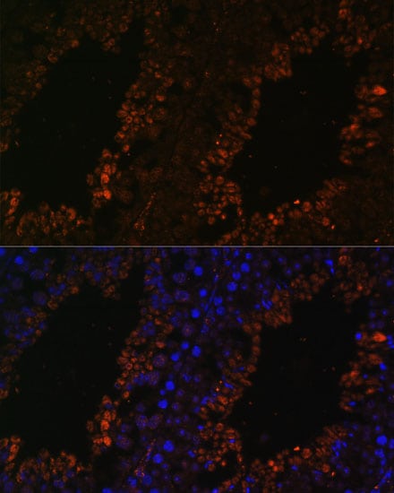 TPD52L3/D55 Antibody