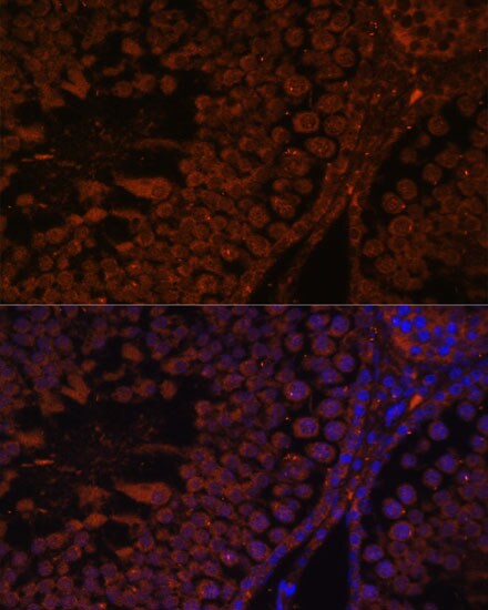 TPD52L3/D55 Antibody