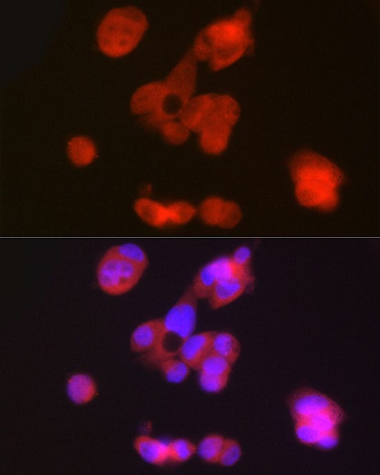 Phenylalanine Hydroxylase Antibody