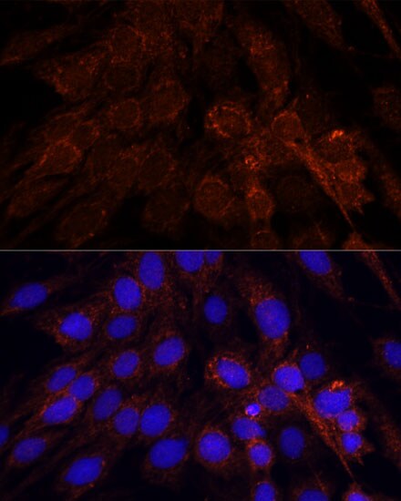 mtRNA polymerase Antibody