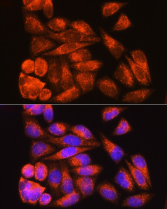 ODF2 Antibody