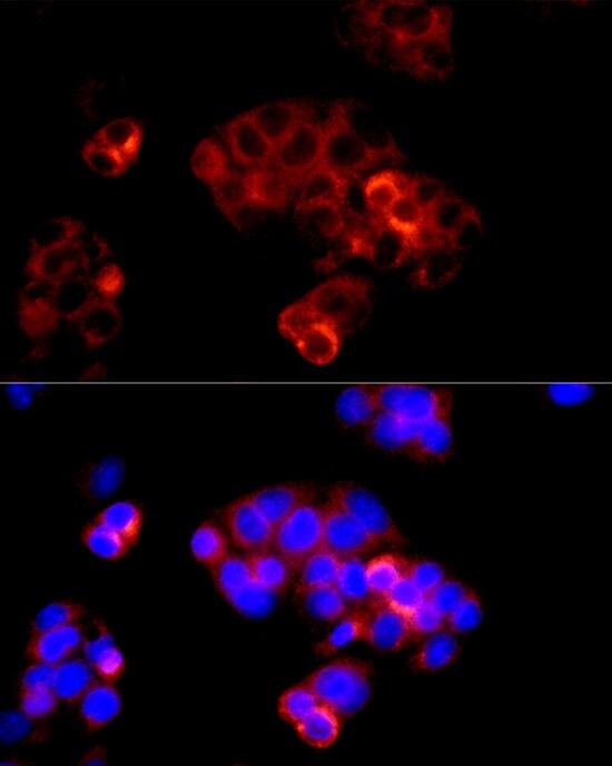 Serpin A8/Angiotensinogen Antibody