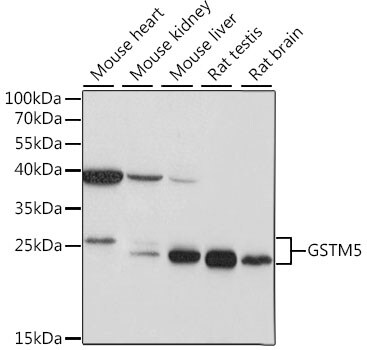 Glutathione S-transferase Mu 5 Antibody