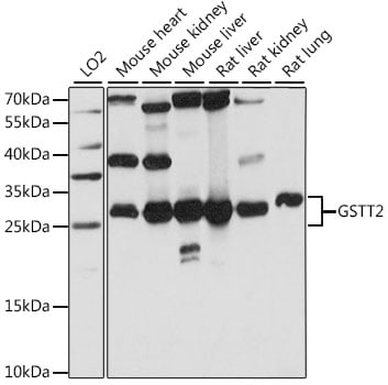 GSTT2 Antibody