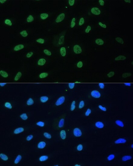 AUF1 Antibody