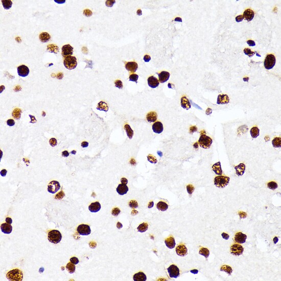 AUF1 Antibody
