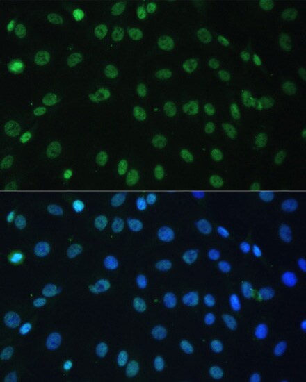 AUF1 Antibody