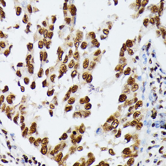 AUF1 Antibody