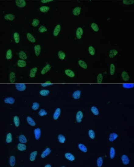AUF1 Antibody