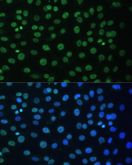 AUF1 Antibody