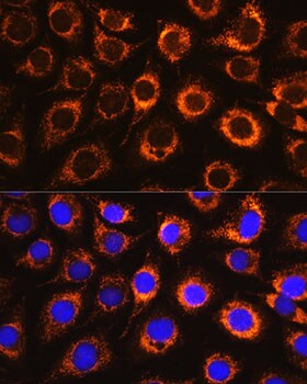Monoamine Oxidase B Antibody