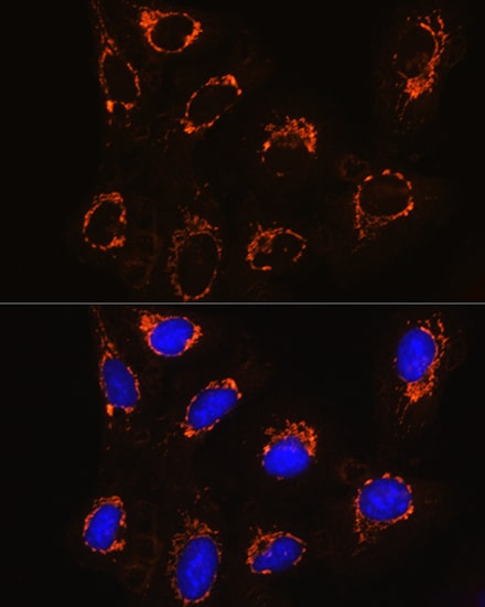 Monoamine Oxidase B Antibody