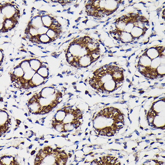 Monoamine Oxidase B Antibody