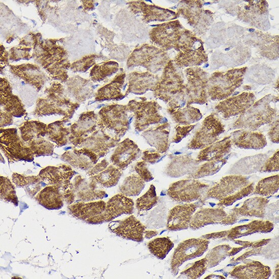 Monoamine Oxidase B Antibody