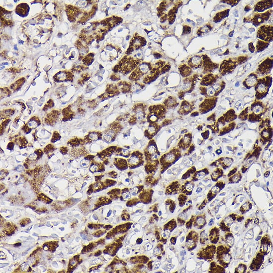 Monoamine Oxidase B Antibody