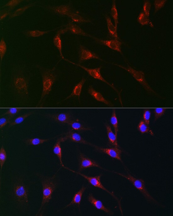Monoamine Oxidase B Antibody