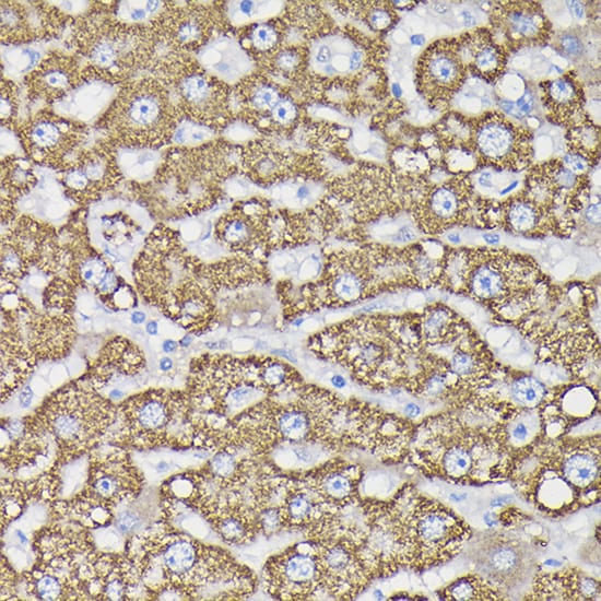 Monoamine Oxidase B Antibody