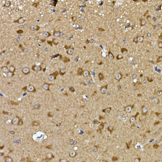 PRPSAP2 Antibody