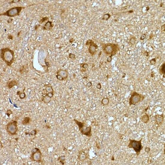 PRPSAP2 Antibody