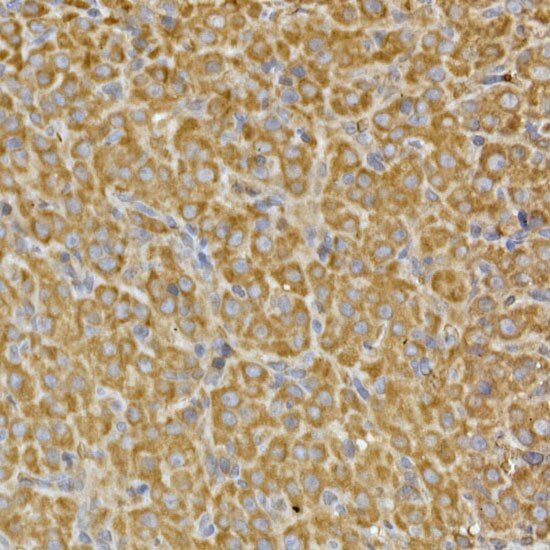 PRPSAP2 Antibody