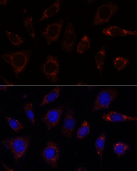 TBRG4 Antibody