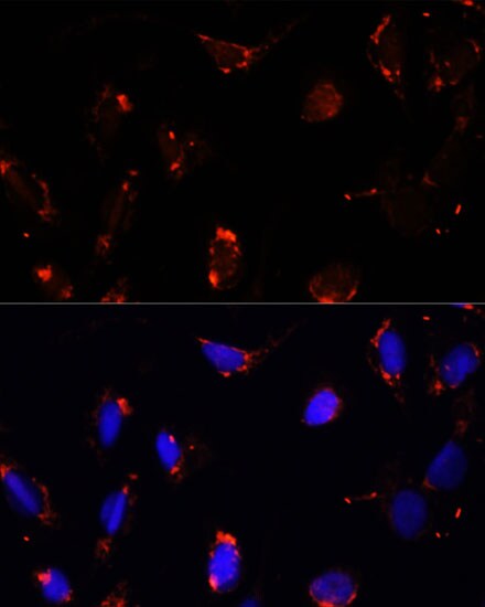 TBRG4 Antibody