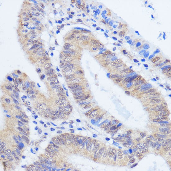 HCC1 Antibody