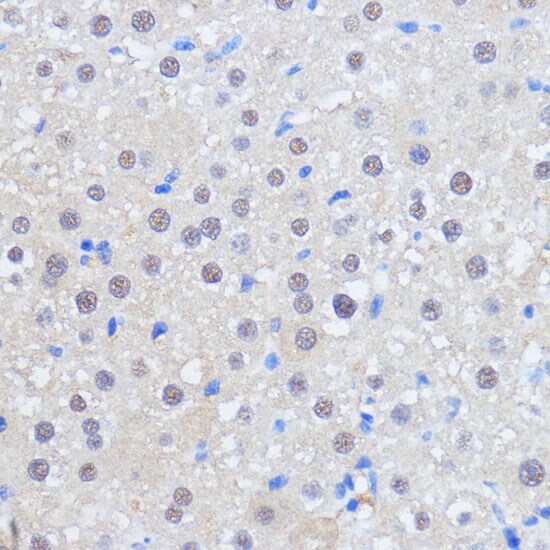 HCC1 Antibody