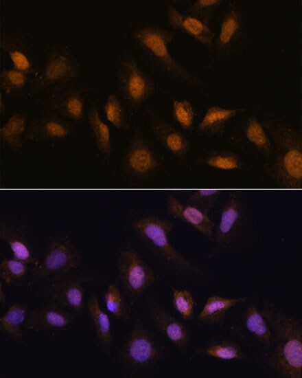 HCC1 Antibody