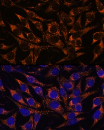 ACAA2 Antibody