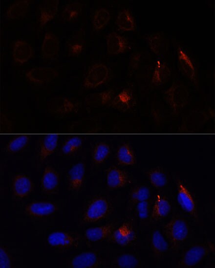Calcium-binding-protein-P22 Antibody