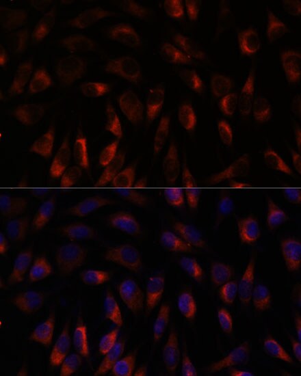 Calcium-binding-protein-P22 Antibody