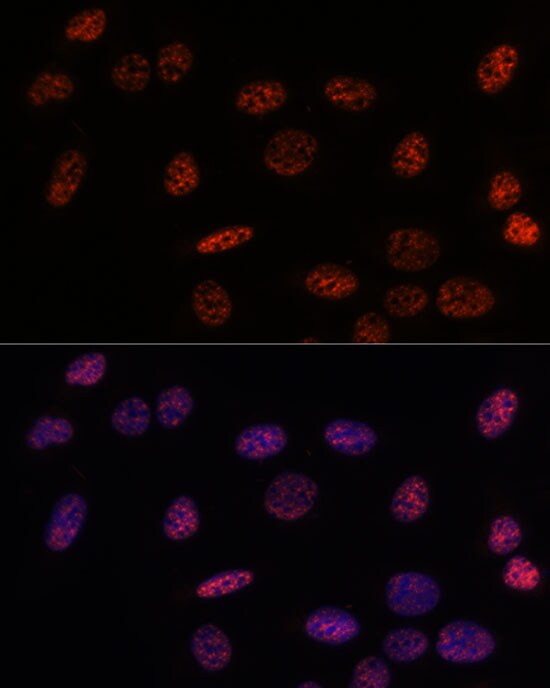 SAP155 Antibody