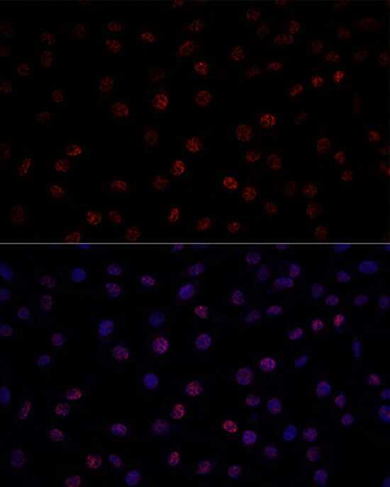 SAP155 Antibody