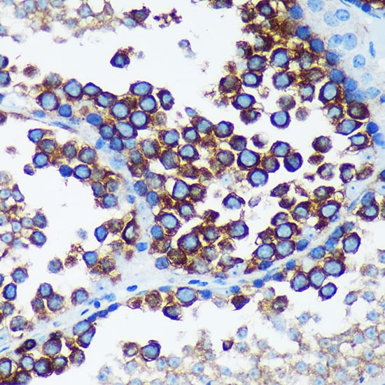 RABGAP1 Antibody