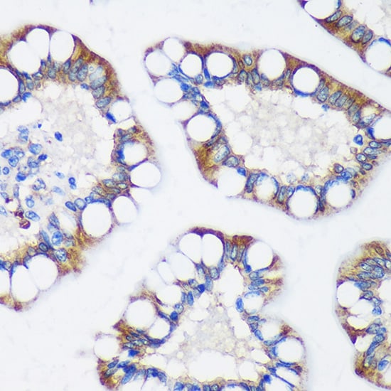 TRIM62 Antibody