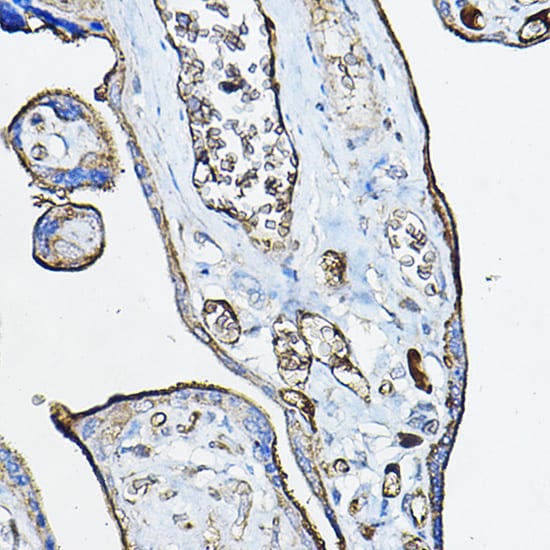 Nicotinic Acetylcholine R alpha 7/CHRNA7 Antibody