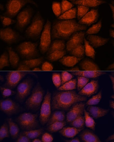 KIF13A Antibody