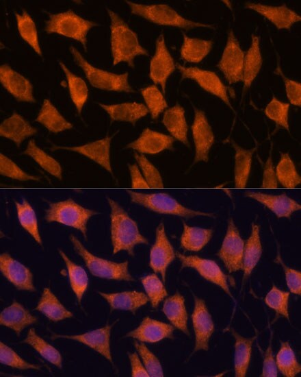 KIF13A Antibody