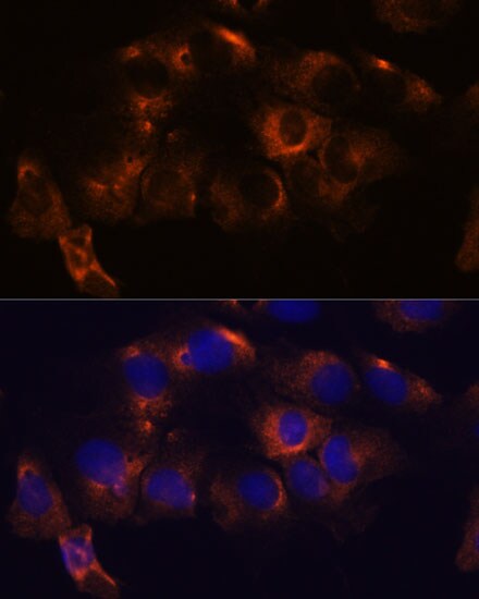 Atlastin-2 Antibody