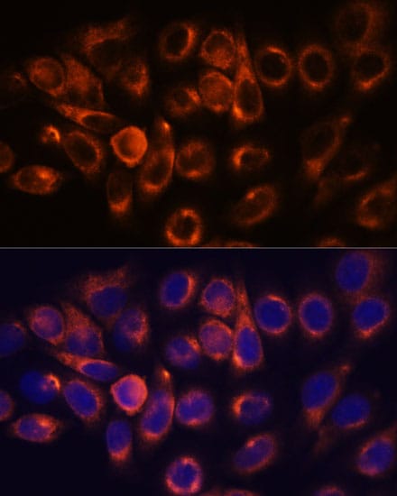 Atlastin-2 Antibody