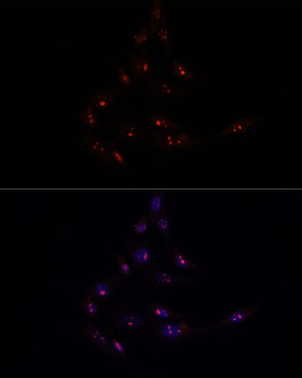 METT10D Antibody